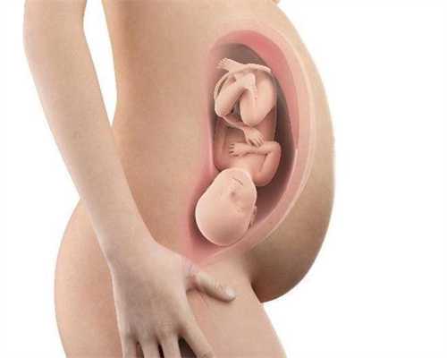 孕临产前注意哪些事项