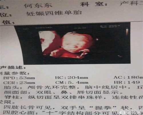 深圳比较好的代孕机构_深圳代孕胚胎移植_安全套暗示如何套出性福生活