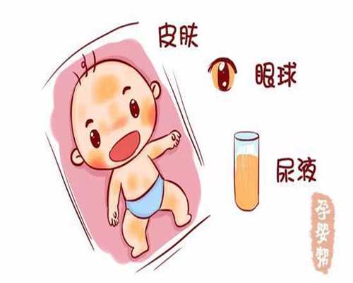 供卵自愿者联系方式_深圳供卵价格一般多少_双胞胎孕晚期怎样做避免早产
