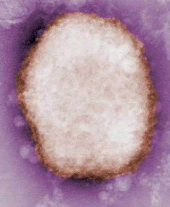 深圳供卵试管私立医院_多国报告人类感染猴痘病例，这 6 个问题你需要知道