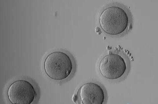 深圳供卵生子咨询 深圳试管婴儿的费用主要分为以下几个方面： ‘彩超看胚胎