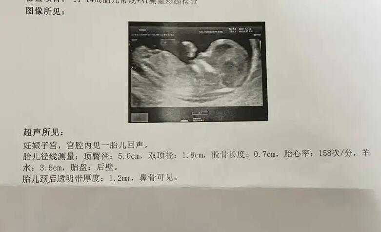 深圳代怀孕专家 1深圳试管婴儿医院大全排行前7的是哪几家 ‘孕囊3.8厘米*2.3厘